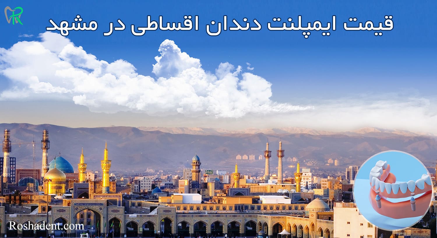 قیمت ایمپلنت در مشهد