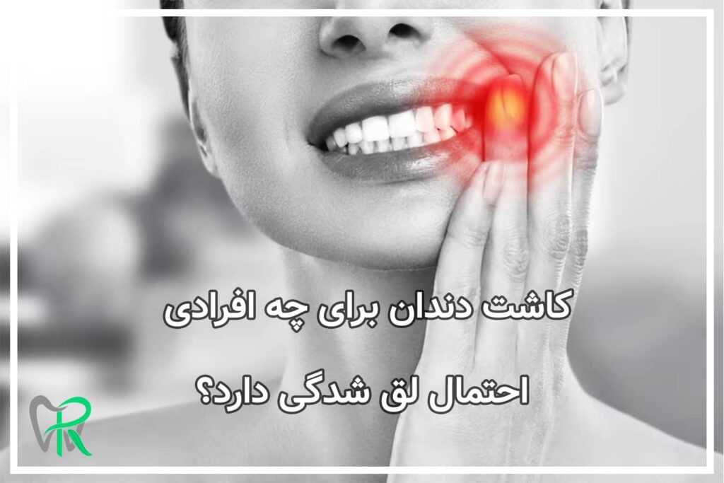 کاشت دندان برای چه افرادی احتمال لق شدگی دارد