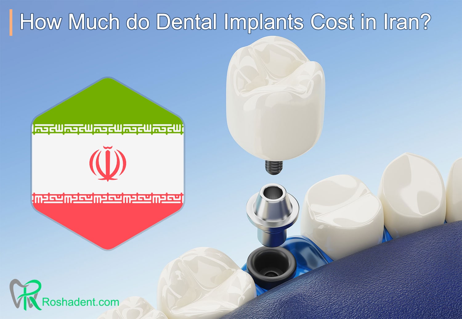 how much do dental implants cost in iran?<