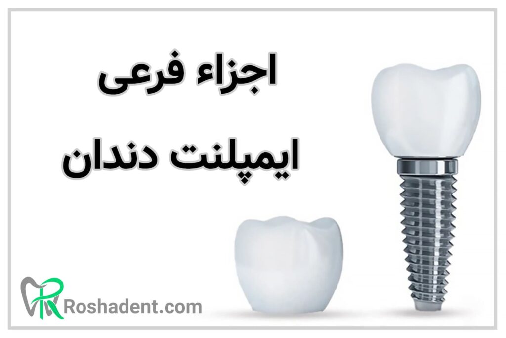 اجزاء فرعی ایمپلنت دندان