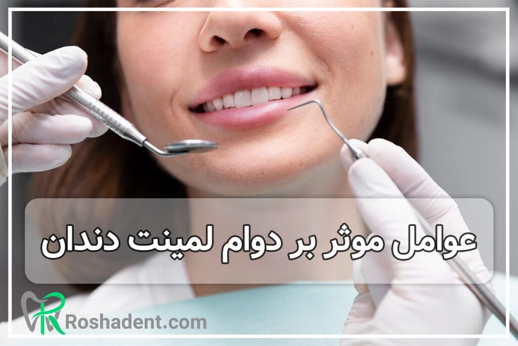 عوامل موثر بر دوام لمینت دندان