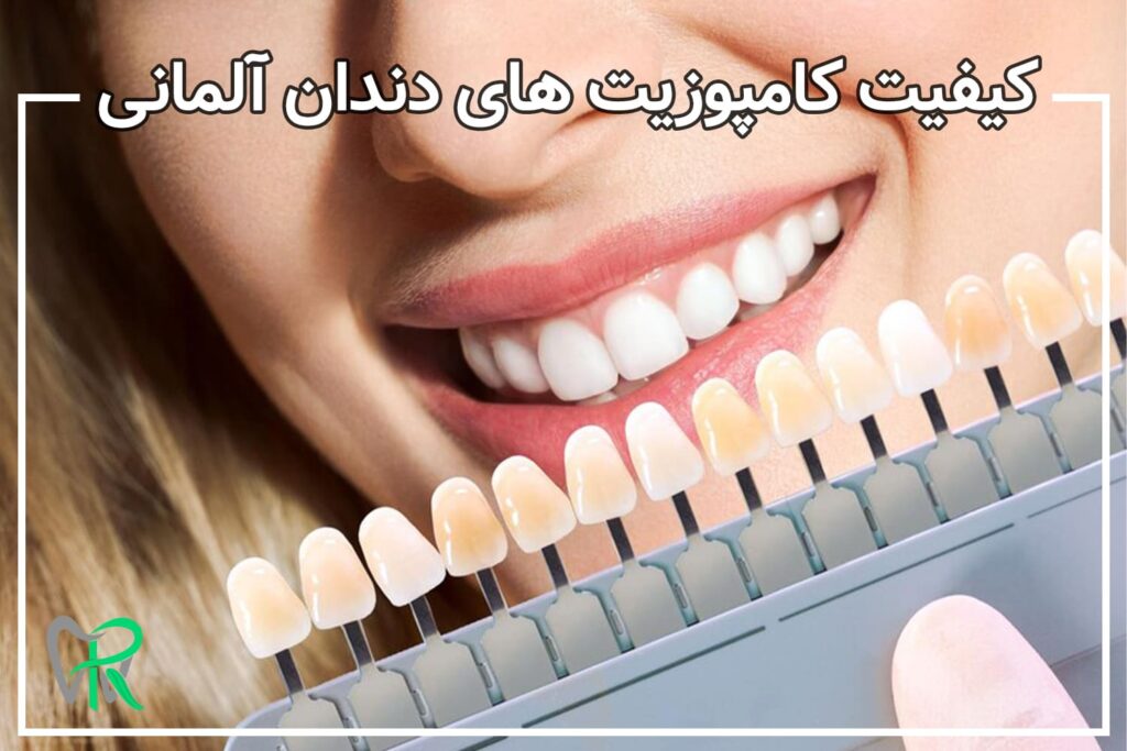 کیفیت کامپوزیت های دندان آلمانی